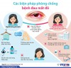 Khuyến cáo phòng bệnh đau mắt đỏ